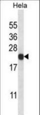 PSMB5 Antibody western blot of HeLa cell line lysates (35 ug/lane). The PSMB5 antibody detected the PSMB5 protein (arrow).