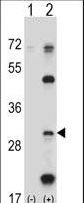 Western blot of PSMB5 (arrow) using rabbit polyclonal PSMB5 Antibody. 293 cell lysates (2 ug/lane) either nontransfected (Lane 1) or transiently transfected (Lane 2) with the PSMB5 gene.