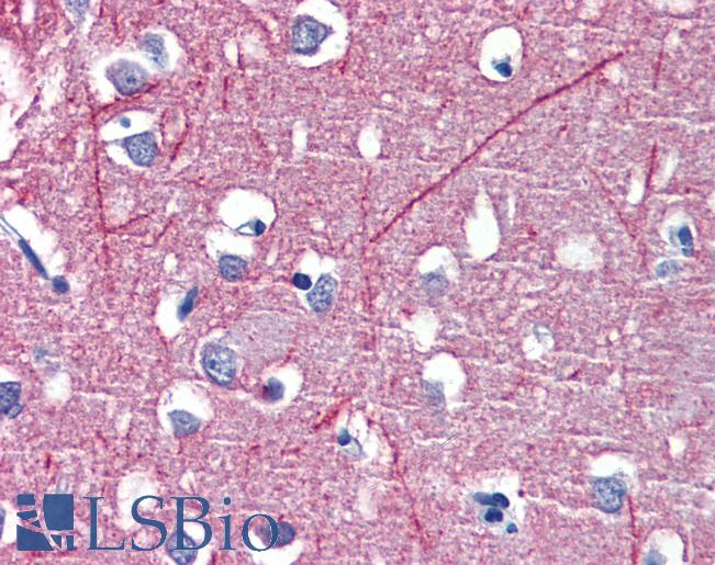 Anti-PSMB5 antibody IHC of human brain, cortex. Immunohistochemistry of formalin-fixed, paraffin-embedded tissue after heat-induced antigen retrieval. Antibody LS-B3830 concentration 3.75 ug/ml.