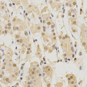 Immunohistochemistry of paraffin-embedded human stomach using PSMB5 antibody at dilution of 1:200 (x400 lens)