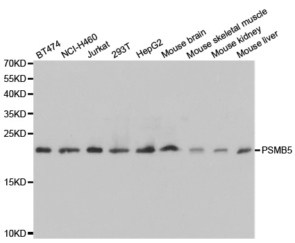 Western blot analysis of extracts of various cell lines, using PSMB5 antibody.