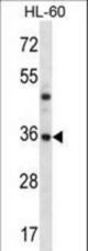 PSMB8 Antibody western blot of HL-60 cell line lysates (35 ug/lane). The PSMB8 antibody detected the PSMB8 protein (arrow).