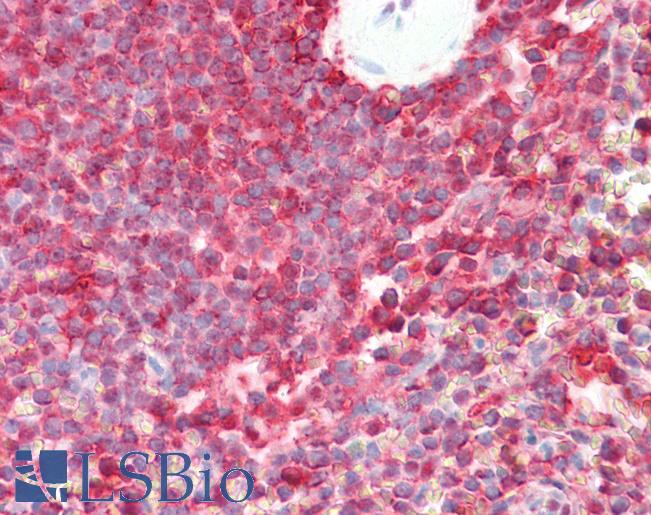 Anti-LMP7 / PSMB8 antibody IHC staining of human spleen. Immunohistochemistry of formalin-fixed, paraffin-embedded tissue after heat-induced antigen retrieval.