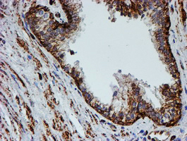 IHC of paraffin-embedded Human prostate tissue using anti-PSMB9 mouse monoclonal antibody.