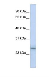 Jurkat cell lysate. Antibody concentration: 1.0 ug/ml. Gel concentration: 12%.