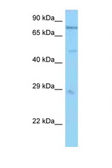 PSMC1 antibody LS-C146282 Western blot of Mouse Heart lysate. Antibody concentration 1 ug/ml.