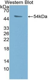Western blot of recombinant PSMC1 / P56.