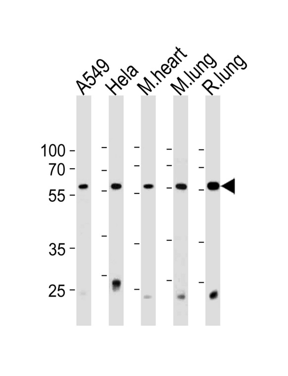 PRS4 Antibody western blot of A549,HeLa cell line and mouse heart and lung,rat lung tissue lysates (35 ug/lane). The PRS4 antibody detected the PRS4 protein (arrow).