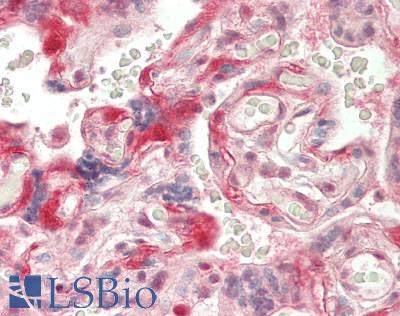 Human Placenta: Formalin-Fixed, Paraffin-Embedded (FFPE)