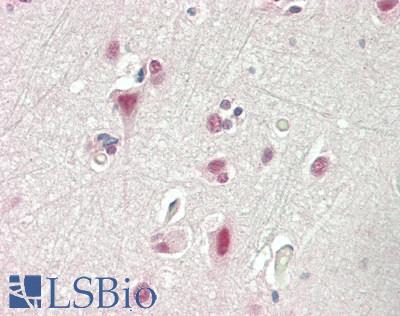 Human Brain, Cortex: Formalin-Fixed, Paraffin-Embedded (FFPE)