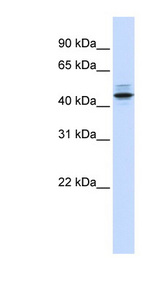 PSMC3 antibody LS-C112167 Western blot of Fetal Lung lysate.