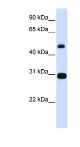 PSMC3 antibody LS-C102755 Western blot of Placenta lysate.