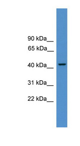 PSMC3 antibody LS-C116982 Western blot of NCI-H226 cell lysate.