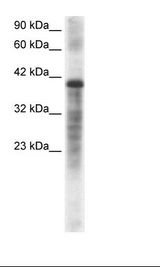 HepG2 Cell Lysate