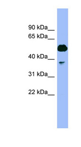 PSMC4 / TBP7 antibody LS-C107812 Western blot of Fetal Muscle lysate.