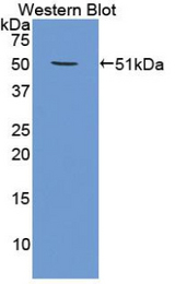 Western blot of recombinant PSMC4 / TBP7.
