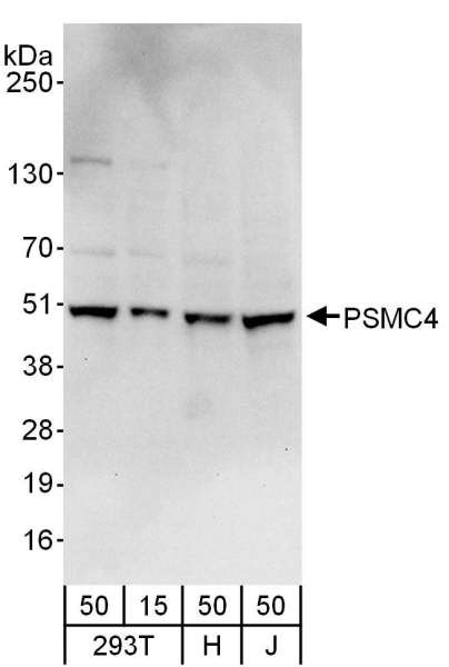 Detection of Human PSMC4 by Western Blot. Samples: Whole cell lysate from 293T (15 and 50 ug), HeLa (H; 50 ug), and Jurkat (J; 50 ug) cells. Antibodies: Affinity purified rabbit anti-PSMC4 antibody used for WB at 0.4 ug/ml. Detection: Chemiluminescence with an exposure time of 10 seconds.