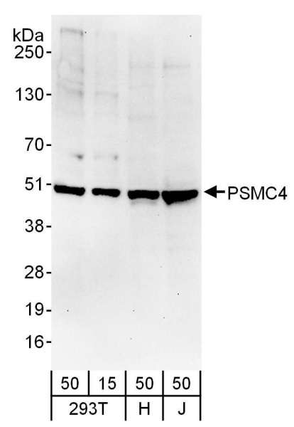 Detection of Human PSMC4 by Western Blot. Samples: Whole cell lysate from 293T (15 and 50 ug), HeLa (H; 50 ug), and Jurkat (J; 50 ug) cells. Antibodies: Affinity purified rabbit anti-PSMC4 antibody used for WB at 0.4 ug/ml. Detection: Chemiluminescence with an exposure time of 30 seconds.
