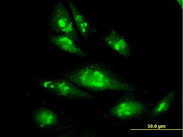 Immunofluorescence of monoclonal antibody to PSMC4 on HepG2 cell. [antibody concentration 10 ug/ml]