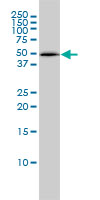 PSMC4 monoclonal antibody (M01), clone 3G8 Western blot of PSMC4 expression in HepG2.