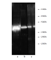 Western blot: Composite luminograph of (a) HeLa S3 cytosolic preparation, (b) purified 26S proteasome, and (c) human placental proteasome fraction after SDS PAGE followed by blotting onto PVDF membrane and probing with antibody BML-PW8830. Antibody dilution 1:5000 using ECL procedure (1 min exposure).