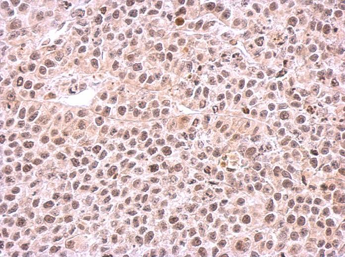IHC of paraffin-embedded HeLa xenograft using PSMC6 antibody at 1:500 dilution.