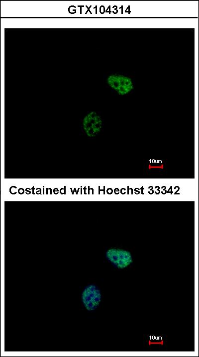 Immunofluorescence of paraformaldehyde-fixed HeLa using PSMC6 antibody at 1:500 dilution.