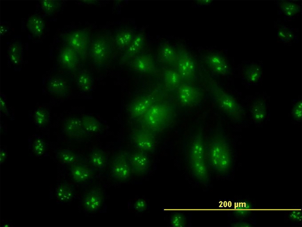 Immunofluorescence of monoclonal antibody to PSMC6 on HeLa cell. [antibody concentration 10 ug/ml]