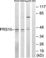 Western blot of extracts from HepG2/293/RAW264.7 cells, using PSMC6 Antibody. The lane on the right is treated with the synthesized peptide.