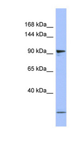 PSMD1 antibody Western blot of Placenta lysate.