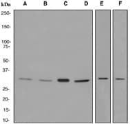 Western blot analysis on (A) HepG2, (B) A431, (C) K562, (D) Namalwa, (E) HeLa, and (F) MCF-7 cell lysates using anti-POH1 antibody.