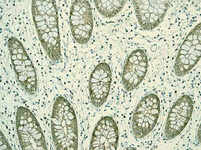 IHC of paraffin-embedded human colon tissue using anti-POH1 antibody.