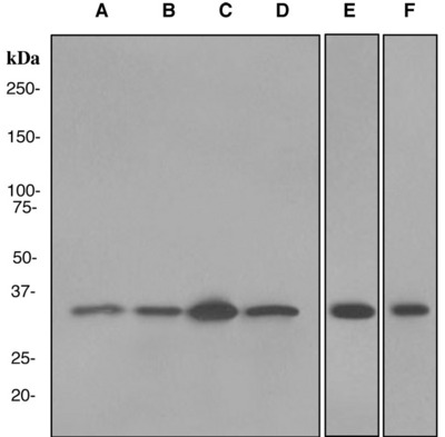 Western blot analysis on (A) HepG2, (B) A431, (C) HeLa, (D) Namalwa, (E) K562, and (F) MCF-7 cell lysates using anti-POH1 antibody.
