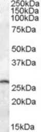 PSPH antibody (0.05 ug/ml) staining of Mouse Brain lysate (35 ug protein/ml in RIPA buffer). Primary incubation was 1 hour. Detected by chemiluminescence.