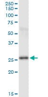 PSPH monoclonal antibody (M01), clone 3A5. Western Blot analysis of PSPH expression in human placenta.