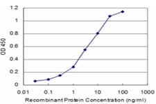 Detection limit for recombinant GST tagged PSPH is approximately 0.3 ng/ml as a capture antibody.