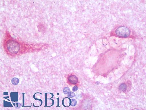 Anti-PSPLA1 / PLA1A antibody IHC staining of human brain, cortex. Immunohistochemistry of formalin-fixed, paraffin-embedded tissue after heat-induced antigen retrieval. Antibody LS-B10189 concentration 10 ug/ml.