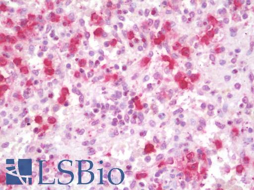 Anti-PSPLA1 / PLA1A antibody IHC staining of human spleen. Immunohistochemistry of formalin-fixed, paraffin-embedded tissue after heat-induced antigen retrieval.