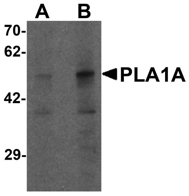 Western blot analysis of PLA1A in human kidney tissue lysate with PLA1A antibody at (A) 1 and (B) 2 ug/ml.