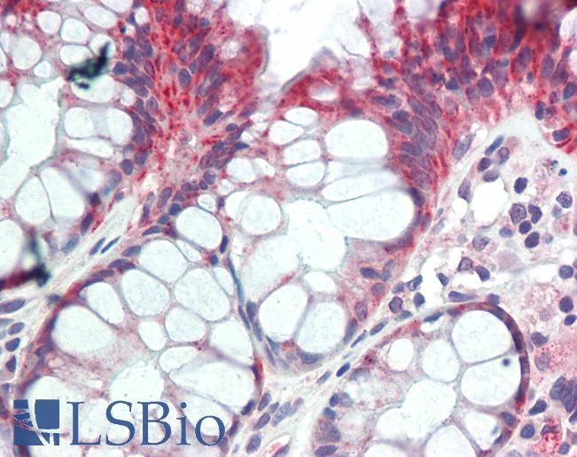 Anti-PSPLA1 / PLA1A antibody IHC staining of human colon. Immunohistochemistry of formalin-fixed, paraffin-embedded tissue after heat-induced antigen retrieval. Antibody LS-B11135 concentration 10 ug/ml.