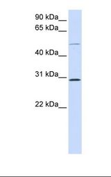293T cell lysate. Antibody concentration: 1.0 ug/ml. Gel concentration: 12%.