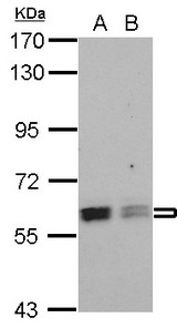 Sample (30 ug of whole cell lysate) A: NT2D1 B: PC-3 7.5% SDS PAGE ROD1 antibody diluted at 1:1000
