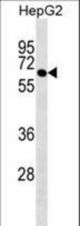 ROD1 Antibody western blot of HepG2 cell line lysates (35 ug/lane). The ROD1 antibody detected the ROD1 protein (arrow).