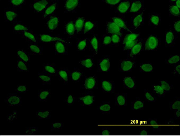 Immunofluorescence of monoclonal antibody to ROD1 on HeLa cell (antibody concentration 20 ug/ml).