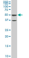ROD1 monoclonal antibody (M01), clone 4C9. Western blot of ROD1 expression in PC-12.