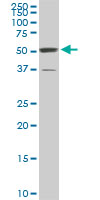 ROD1 monoclonal antibody (M01), clone 4C9. Western blot of ROD1 expression in NIH/3T3.