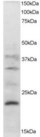 Staining (2 ug/ml) of Human Pancreas lysate (RIPA buffer, 30 ug total protein per lane). Primary incubated for 1 hour. Detected by chemiluminescence.
