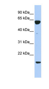 PTP4A3 antibody LS-C111303 Western blot of 293T cell lysate.