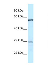 PTPN6 antibody LS-C145506 Western blot of 1 Cell lysate. Antibody concentration 1 ug/ml.