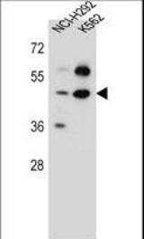 SC65 Antibody western blot of NCI-H292,K562 cell line lysates (35 ug/lane). The SC65 antibody detected the SC65 protein (arrow).